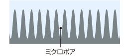 acfのミクロポア